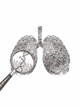 Archivo - Investigación sobre el cáncer de pulmón.