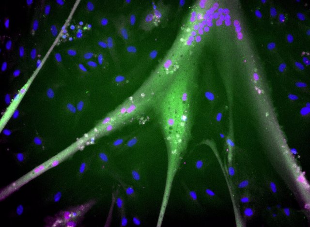 Células madre bovinas inmortalizadas diferenciadas con proteínas musculares totalmente expresadas (azul = núcleos; magenta = miogenina; verde = miosina). Escala aprox 1 mm.