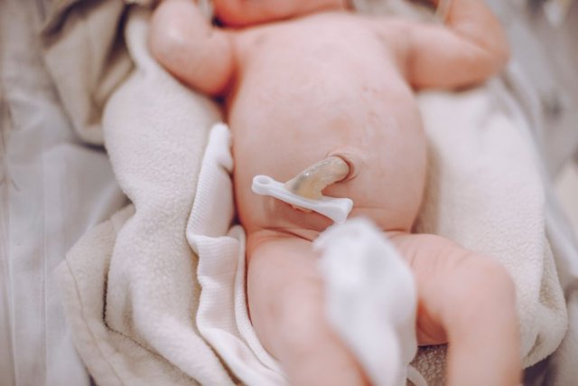 Imatge d'un cordó umbilical