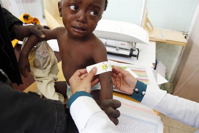 Archivo - El PMA atiende a un niño malnutrido en Yemen 