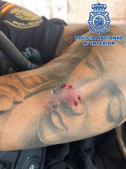 Una mujer muerde a dos policías cuando iba a ser detenida por agredir con su marido con un cuchillo