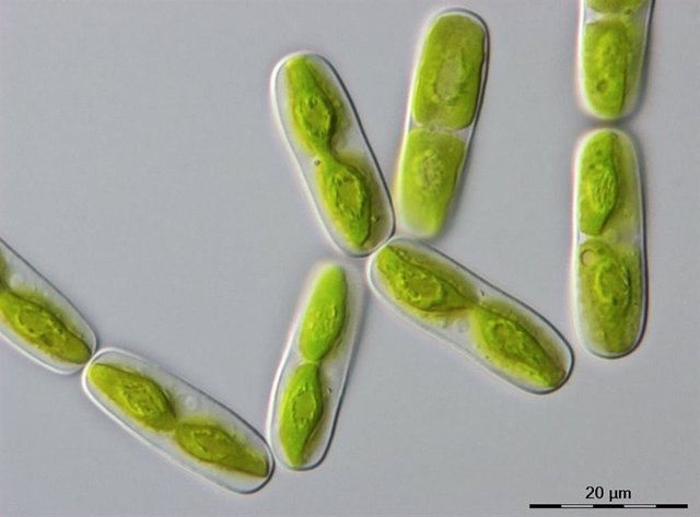 Imagen microscópica de una de las algas más cercanas a las plantas terrestres, un alga unicelular llamada Mesotaenium endlicherianum (20 micrómetros corresponden a 0,02 milímetros)