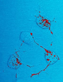 Archivo - Células nerviosas de ratón con priones (en rojo)