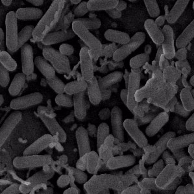 Archivo - Imagen de archivo de bacterias del género listeria al microscopio
