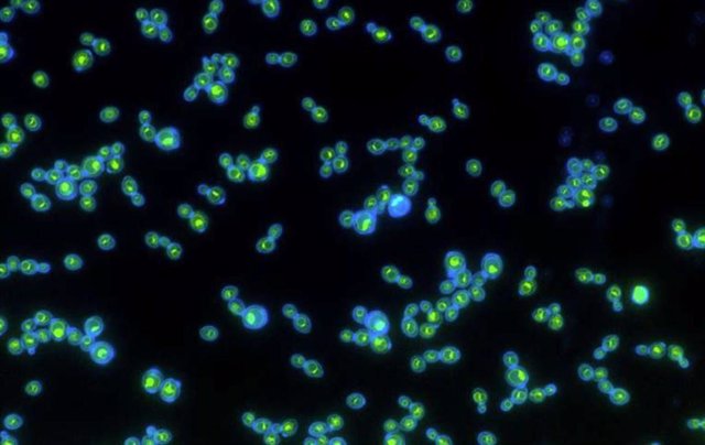 Las proteínas de rodopsina verdes dentro de las paredes celulares azules ayudan a que estas levaduras crezcan más rápido cuando se exponen a la luz.
